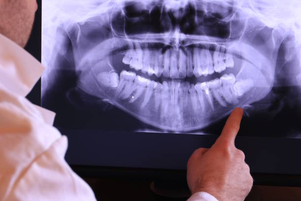 Best Emergency Dental Care for Sports Injuries in Kittanning, PA